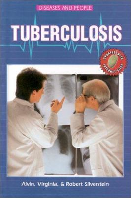 Tuberculosis