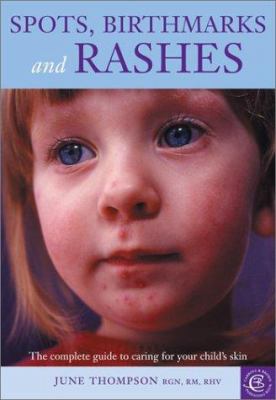 Spots, birthmarks and rashes : the complete guide to caring for your child's skin