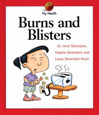 Burns and blisters