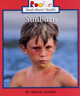 Sunburn