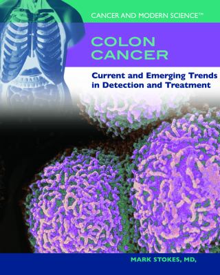 Colon cancer : current and emerging trends in detection and treatment