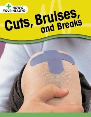Cuts, bruises, and breaks