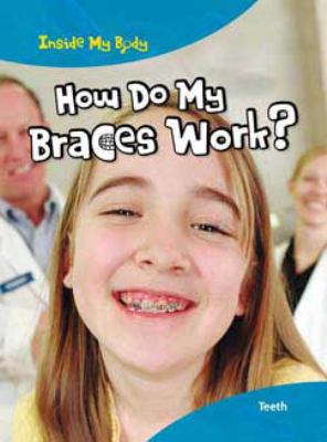 How do my braces work?