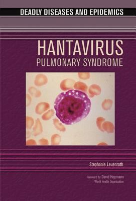 Hantavirus pulmonary syndrome