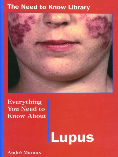 Everything you need to know about lupus