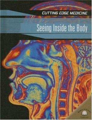 Seeing inside the body