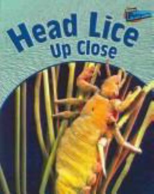 Head lice up close