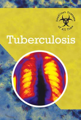 Tuberculosis