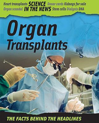 Organ transplants