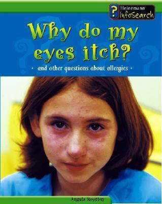 Why do my eyes itch? : and other questions about allergies