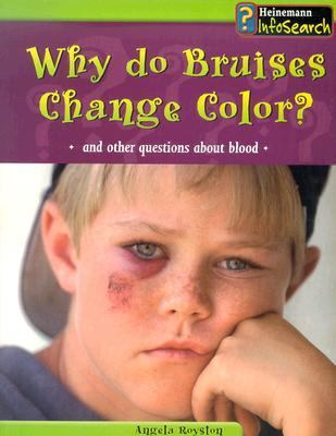 Why do bruises change color? : and other questions about blood