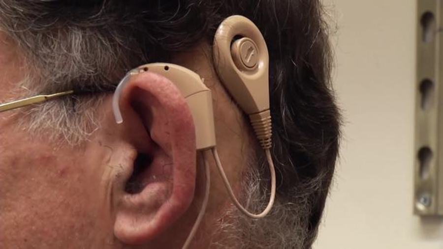 Cochlear Implants : Music to Your Ears
