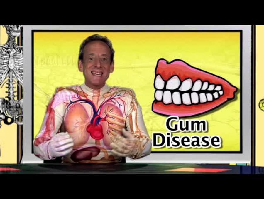 Healthy Gums and Gingivitis