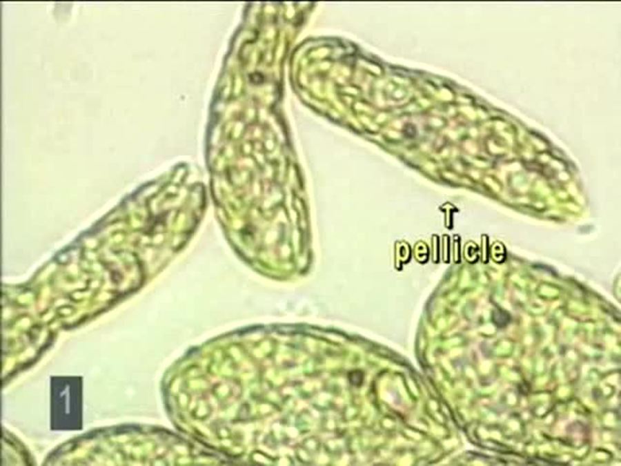 Protists Pt. 2 : Euglena, Plasmodial Slime Mold
