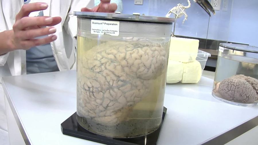 How big is a human brain?