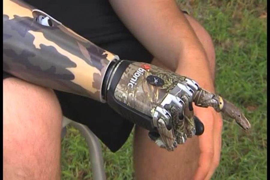 Engineering : Prosthetic Innovations  : Show Me Science