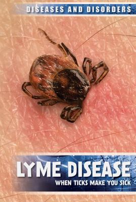 Lyme disease : when ticks make you sick