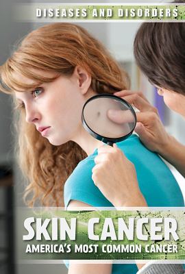 Skin cancer : America's most common cancer