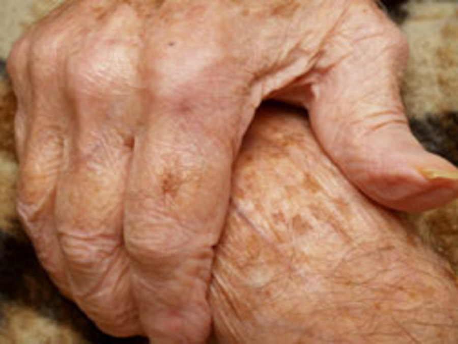 Assessing skin conditions in the elderly