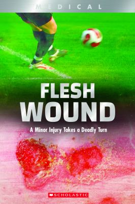 Flesh wound : a minor injury takes a deadly turn