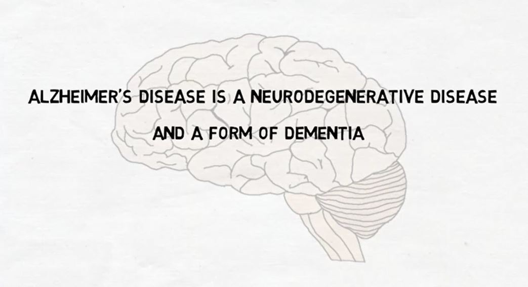 Alzheimer's Disease.