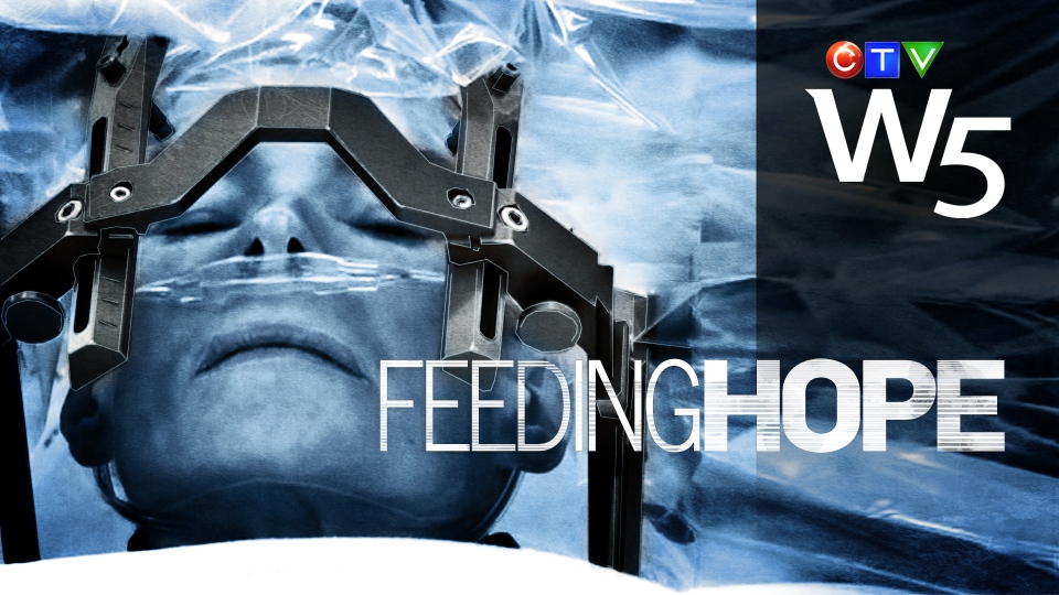 Feeding Hope: W5.