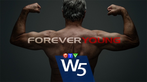 Forever Young: W5.