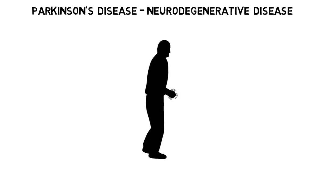 Parkinson's Disease.