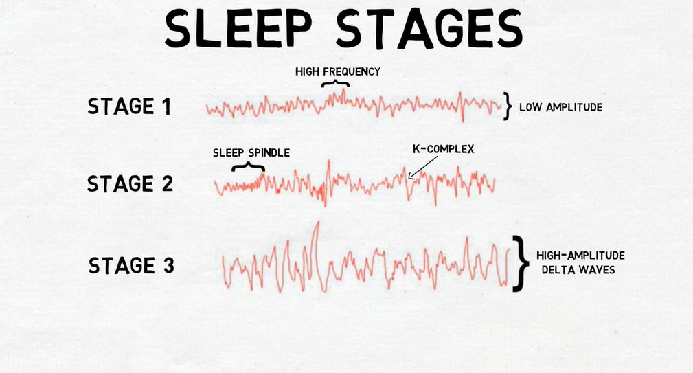 Stages of Sleep.