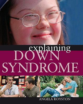 Explaining down syndrome