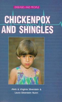 Chickenpox and shingles