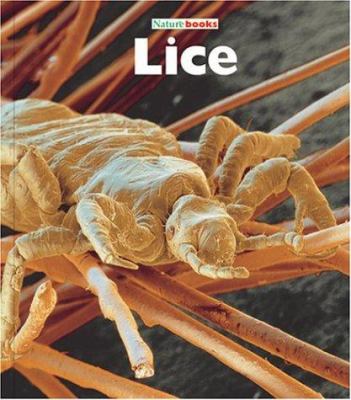 Lice