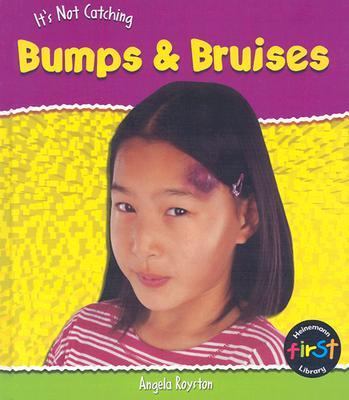 It's not catching : bumps and bruises