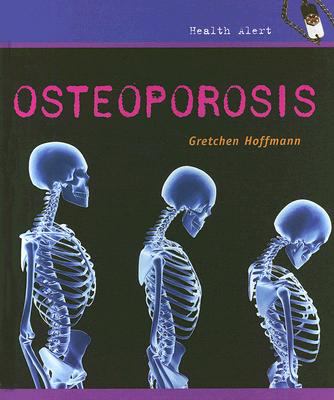 Osteoporosis