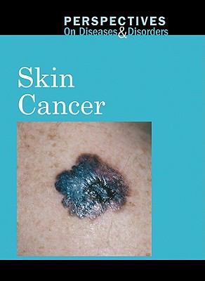 Skin cancer