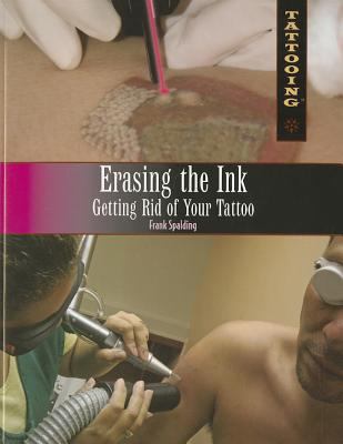 Erasing the ink : getting rid of your tattoo