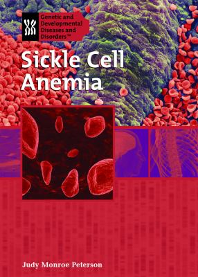 Sickle cell anemia