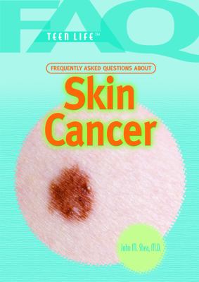 Frequently asked questions about skin cancer