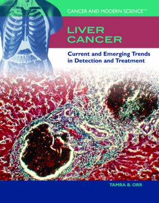 Liver cancer : current and emerging trends in detection and treatment