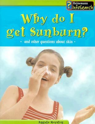 Why do I get a sunburn? : and other questions about skin