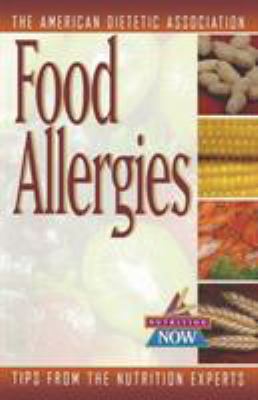 Food allergies : how to eat safely and enjoyably