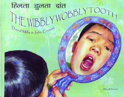 The wibbly wobbly tooth