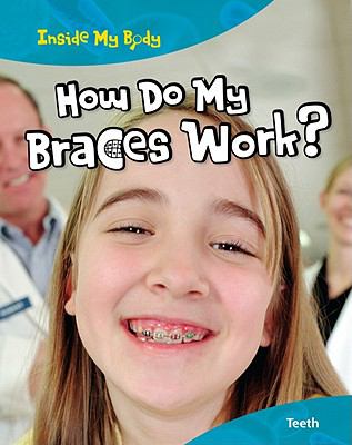 How do my braces work? : teeth