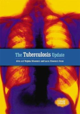 The tuberculosis update