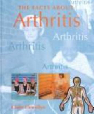 The facts about arthritis