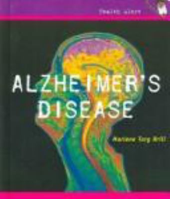 Alzheimer's disease