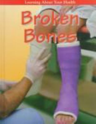 Broken bones