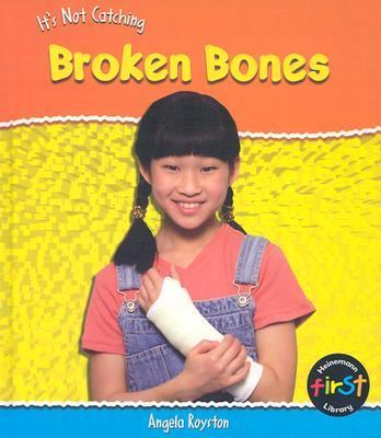 It's not catching : broken bones