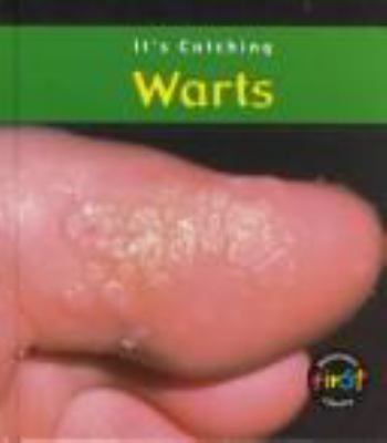 Warts